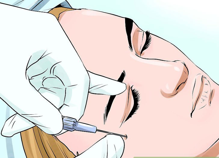 مرکز تزریق ژل گونه در کرج