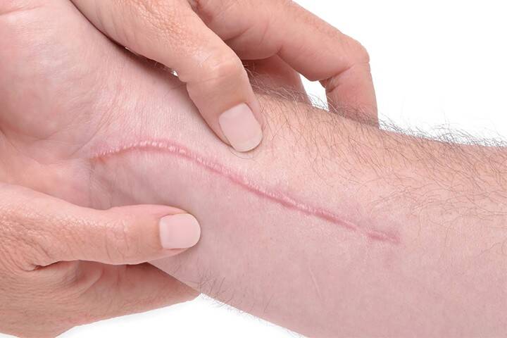 مرکز رفع اسکار در کرج