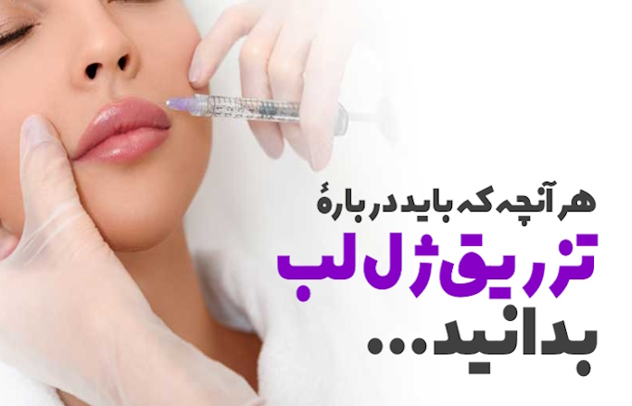 بهترین جا برای تزریق ژل لب در کرج کجاست؟