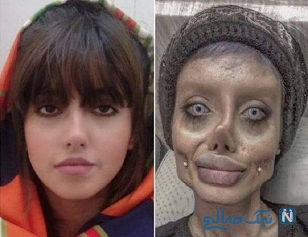 جراحی زیبایی اینستاگرام