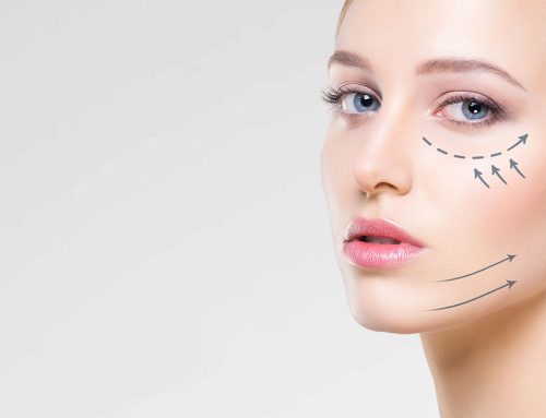 تزریق فیلر گونه در کرج/ هزینه تزریق فیلر گونه/ عوارض تزریق فیلر گونه