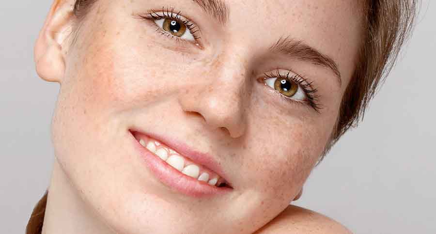 دلیل ایجاد کک و مک صورت چیست؟