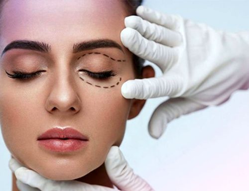 بوتاکس چشم گربه ای در کرج/ مرکز بوتاکس کرج