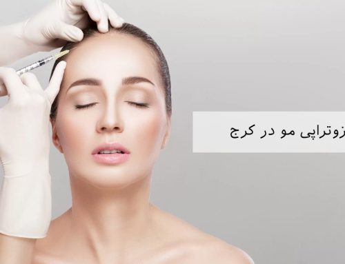 مزوتراپی مو در کرج/ تقویت مو با مزوتراپی