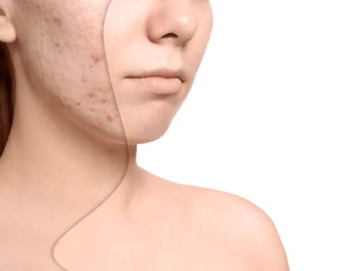سابسیژن در کرج/ دکتر خوب برای سابسیژن در کرج