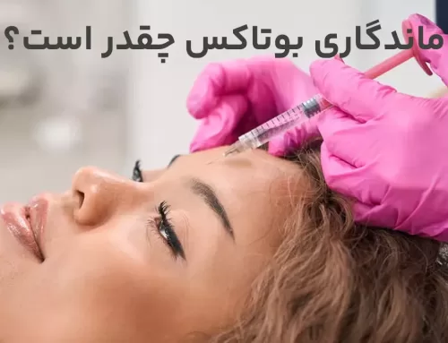 ماندگاری بوتاکس چقدر است؟