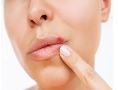 عوارض تزریق ژل های ارزان و بی کیفیت