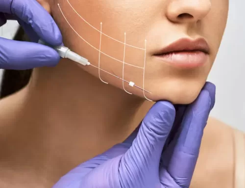 بهترین دکتر برای نخ صورت در کرج