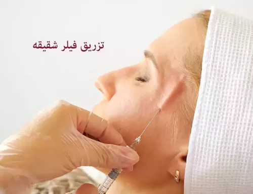 تزریق فیلر شقیقه در کرج