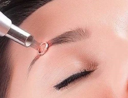 مركز تخصصی پاك كردن تاتو ابرو در کرج