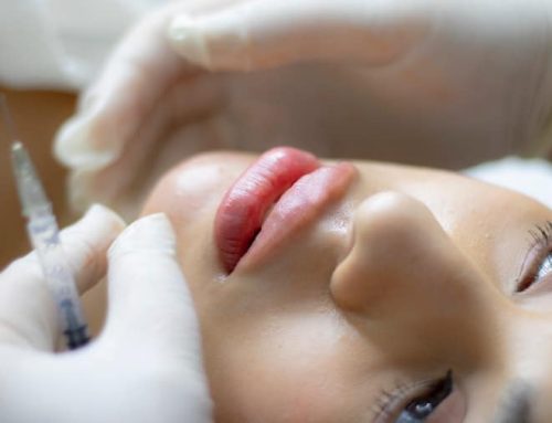 هزینه تزریق ژل برای چاقی صورت در کرج